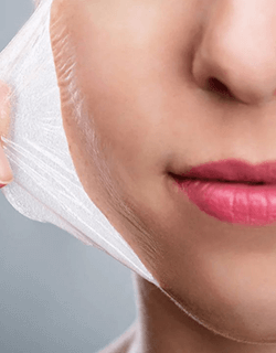 Chemical Peel