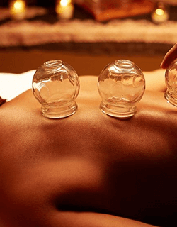 Cupping Therapy